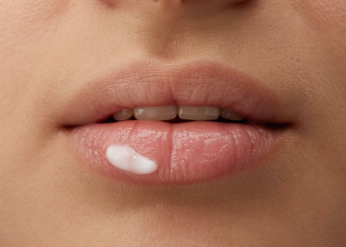 Abreva healing stages: photos showing a cold sore on a lip from the tingling stage to fully healed skin after using Abreva.