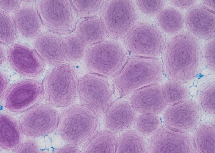 Microscopic view of onion epidermal cells showing cell walls and nuclei.