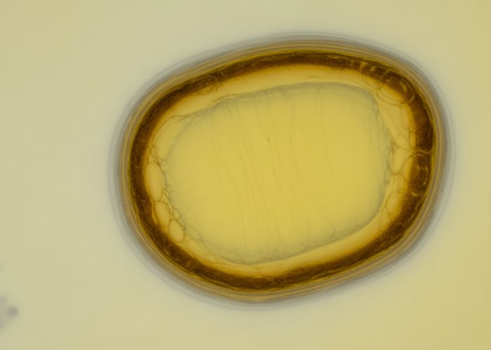 Microscopic image of a hyaline cast in urine, a sign of potential kidney issues.